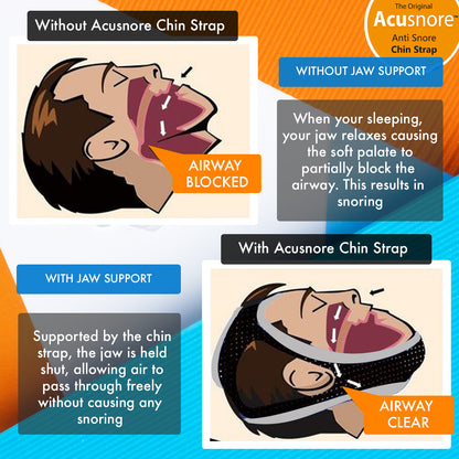 Acusnore Anti-Snore Chin Strap – Your Key to Quieter, Restful Sleep