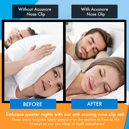 Acusnore Anti-Snore Magnetic Nose Clip – Natural Snoring Relief & Better Sleep