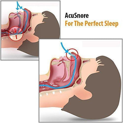 Acusnore Air Flow Nose Vents - 5 Options